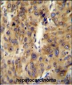 ACF Antibody (C-term)